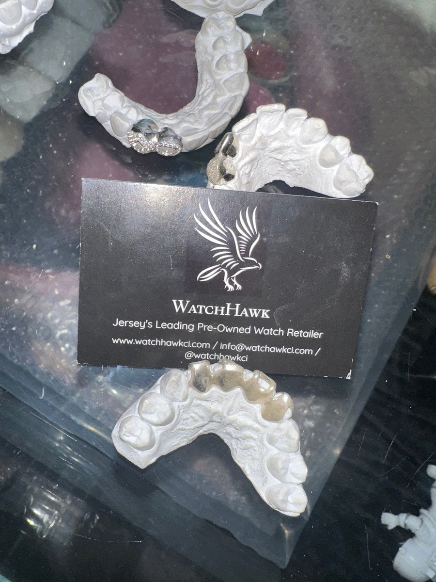 Bespoke grill dental mould — Watchhawk